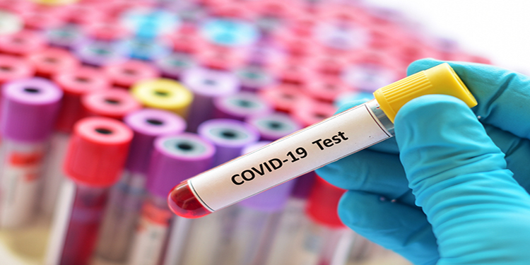 Is Quidel a Good Coronavirus Stock to Buy? Analyst Weighs In