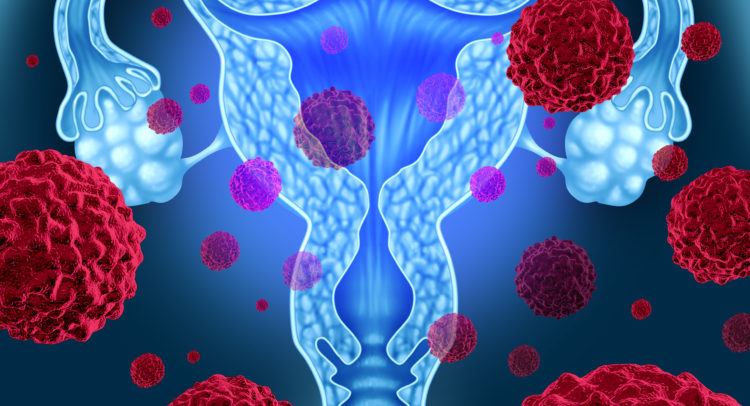 AstraZeneca-Merck Ovarian Cancer Treatment Gets FDA Approval