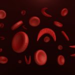 Global Blood Therapeutics: Can This Biotech Still Disrupt The Sickle Cell Disease Space?