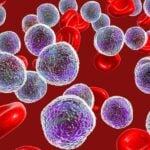 Why Is Aptevo Therapeutics Stock (APVO) Up 50% Today?