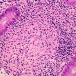 Why Is Cue Biopharma Stock Up Today?